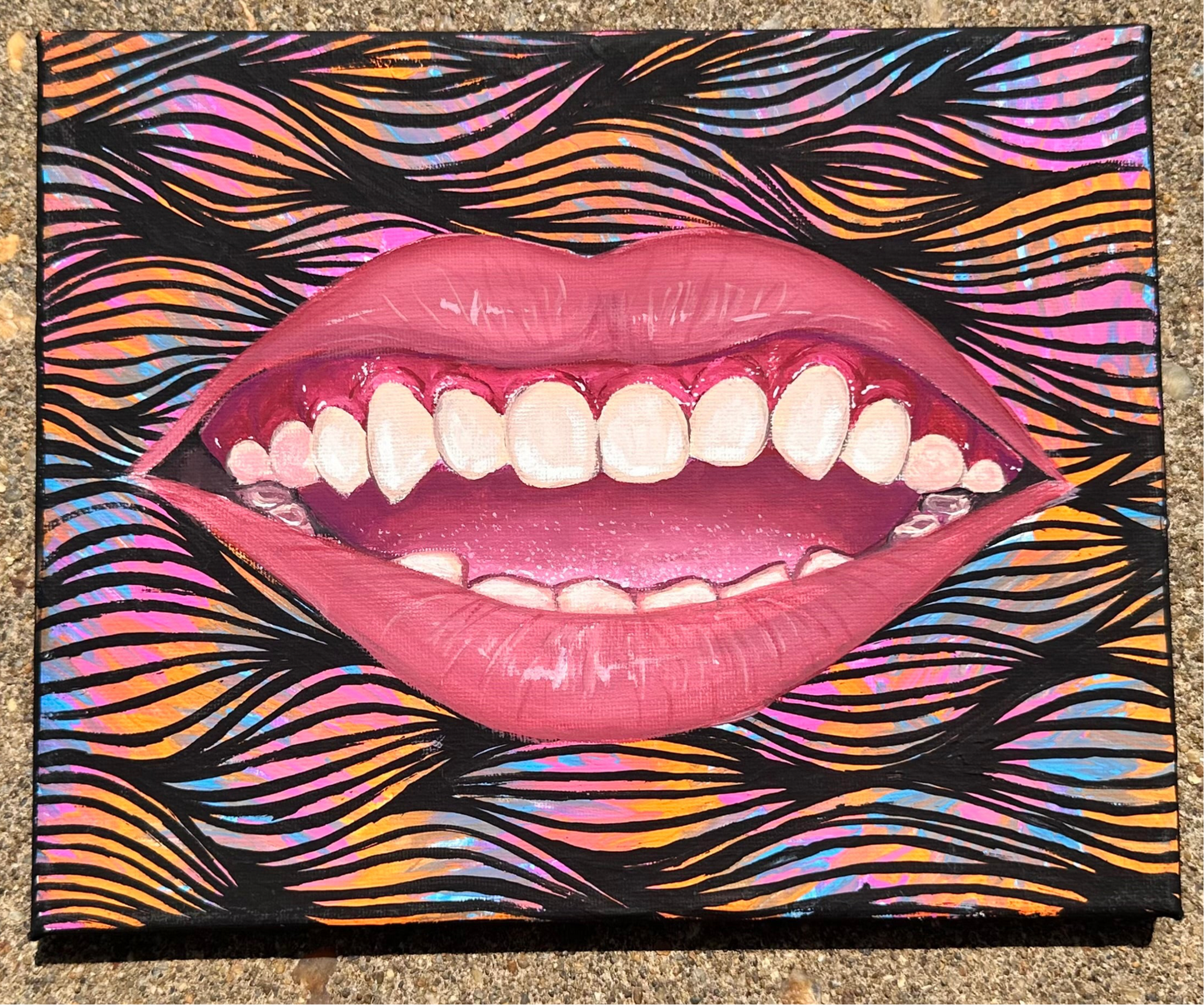 Gums